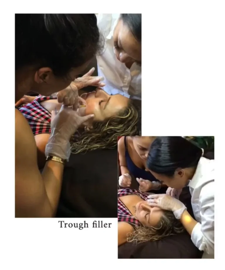 filler5