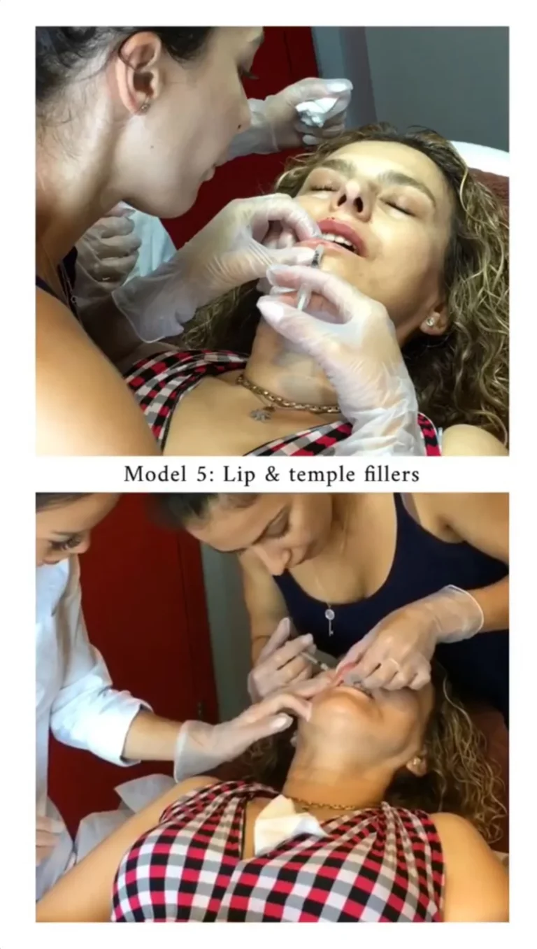 filler8