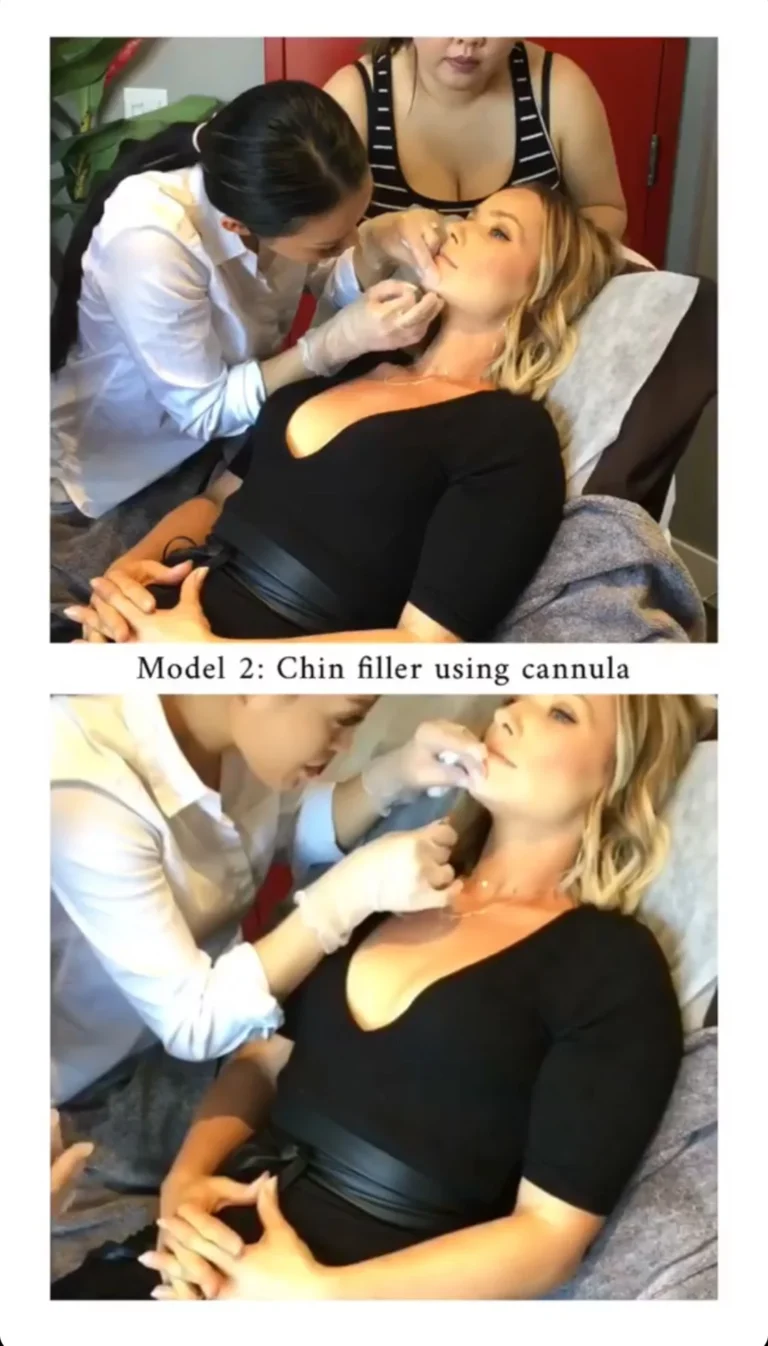 filler9