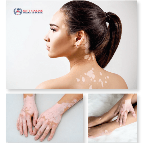 scar camouflage tattoo course